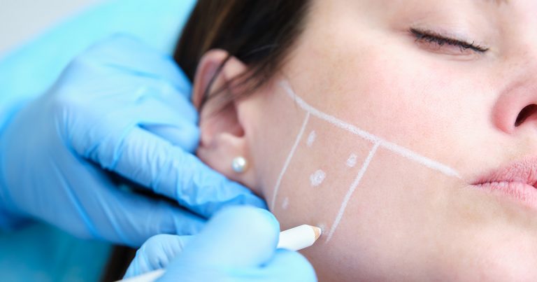 Botox para bruxismo: solução inovadora