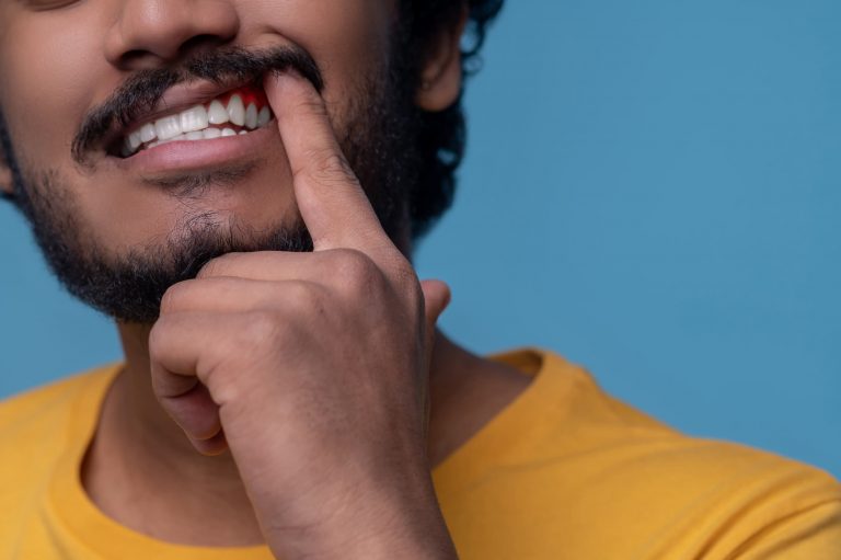 Cirurgia plástica gengival é um procedimento para melhorar a harmonia entre lábios, dentes e linhas do sorriso